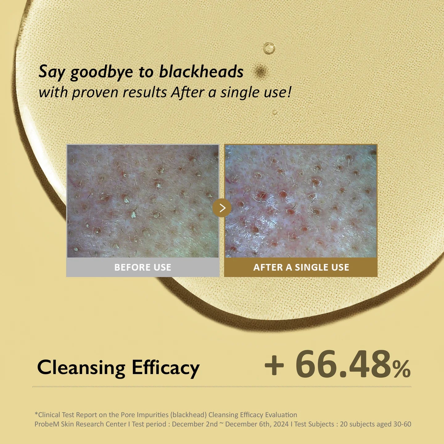 Haruharu Wonder Black Rice Moisture Deep Cleansing Oil 150ml