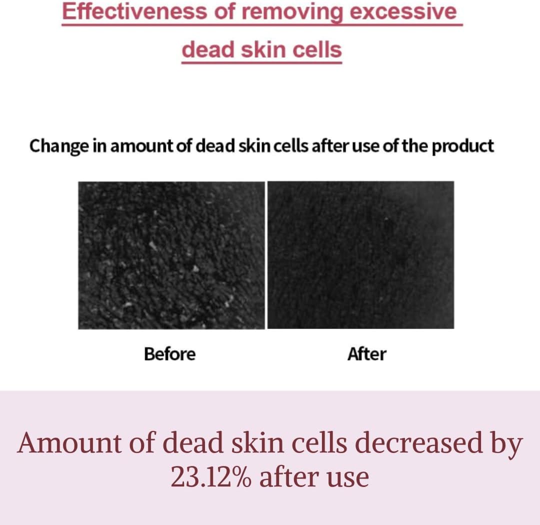 [Clearance] I'm from Fig Boosting Essence 150ml