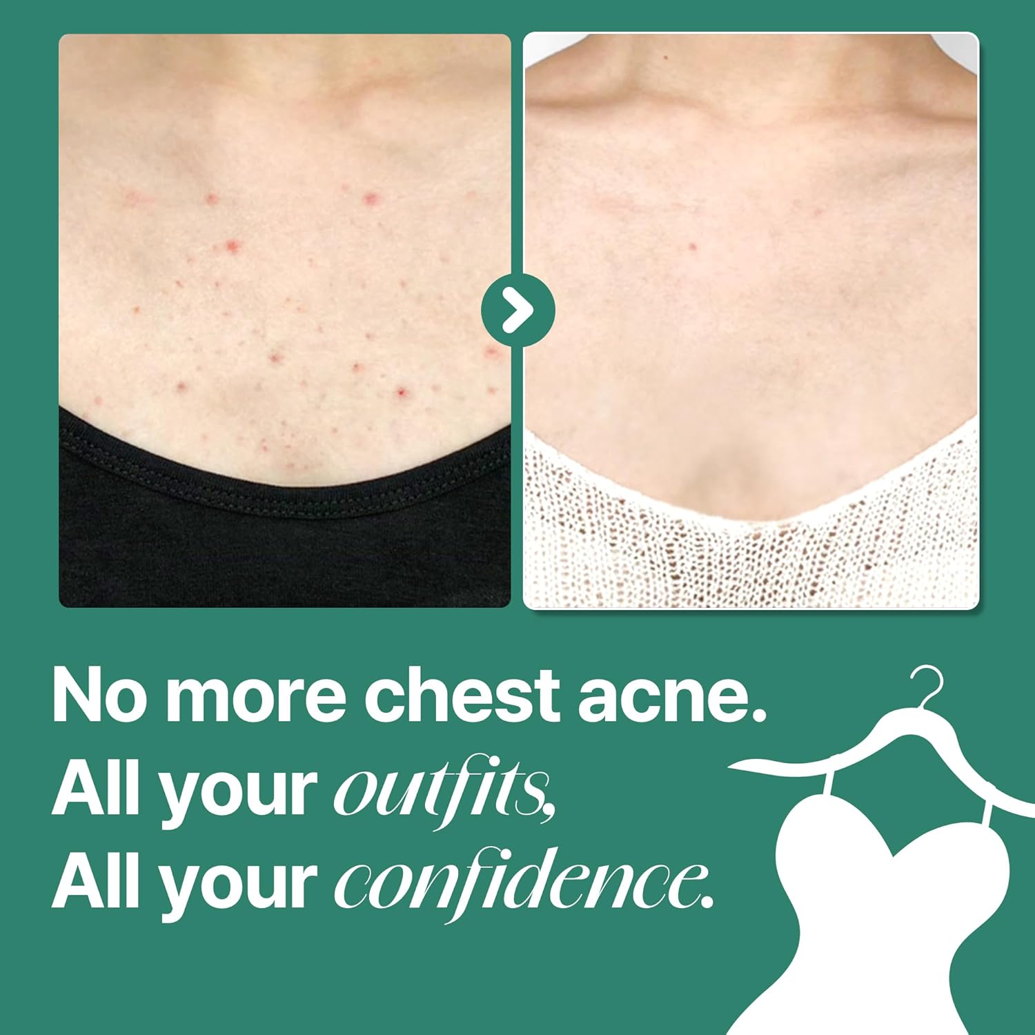 Second Chance SOME BY MI AHA BHA PHA 30 Days Miracle Acne Clear Body Cleanser 400g