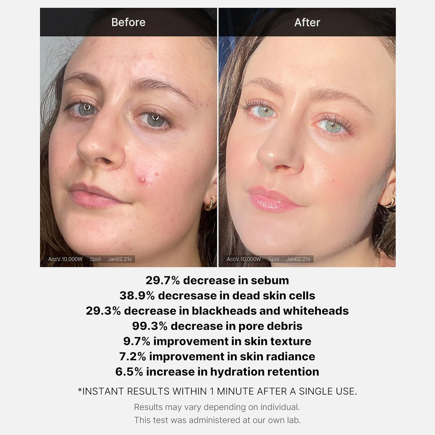 Medicube Red Succinic 21% Acid Cleansing Booster Serum 40g